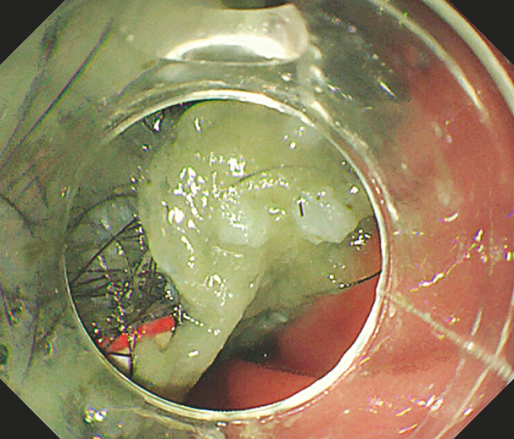 Fig. 1