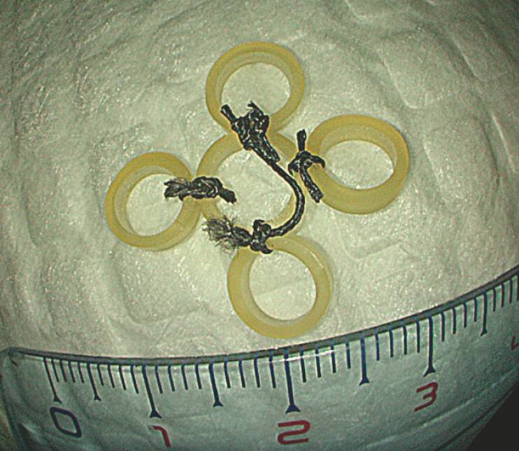 Fig. 1