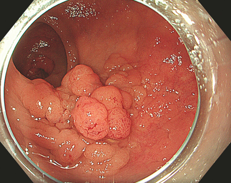 Fig. 2
