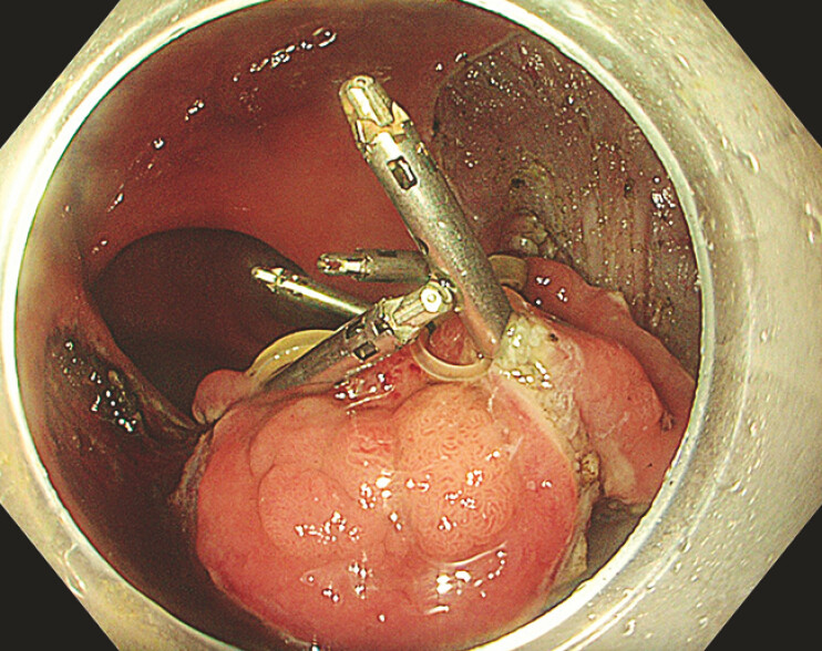 Fig. 3