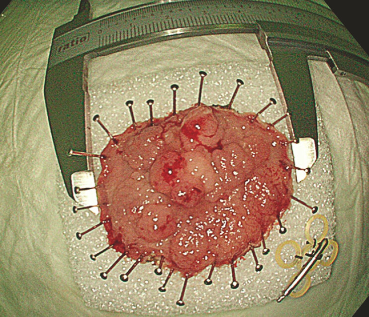 Fig. 4
