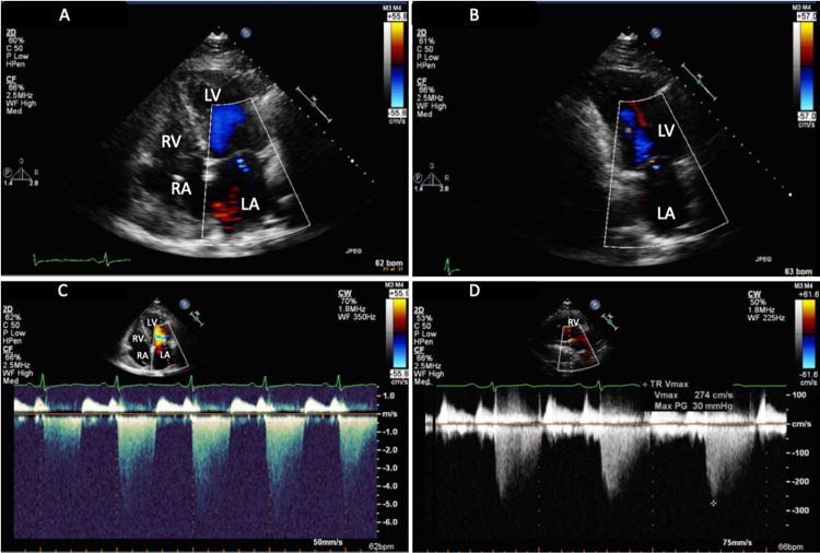 Figure 4