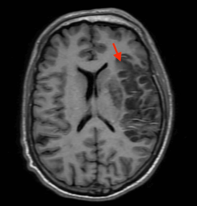 Figure 5