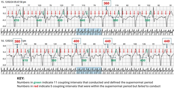 FIGURE 4
