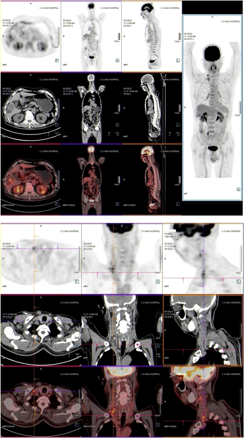 Figure 3