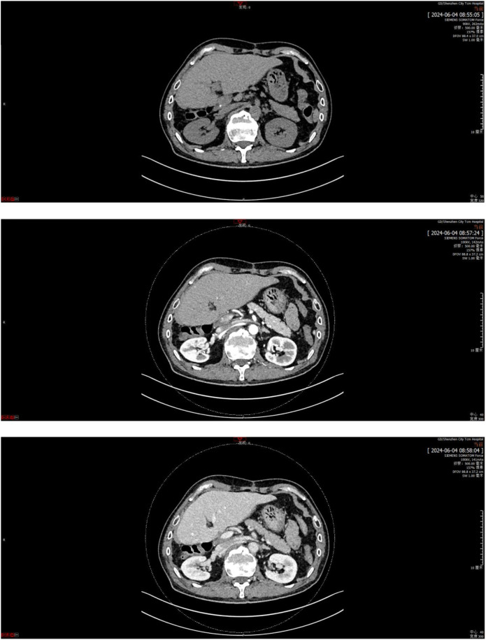 Figure 4