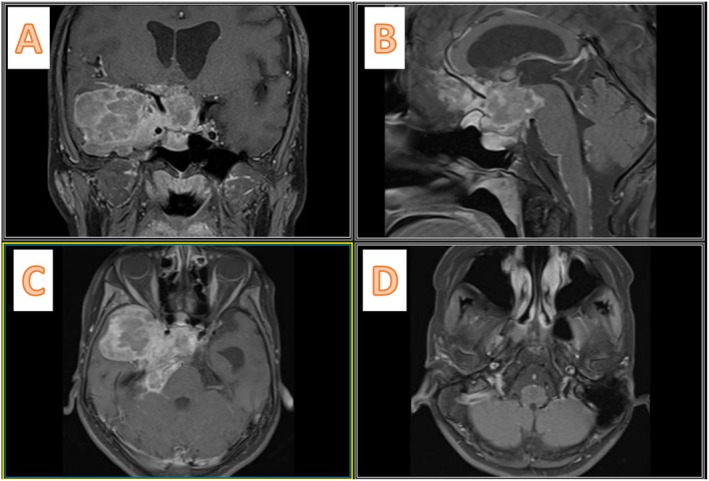 FIGURE 4