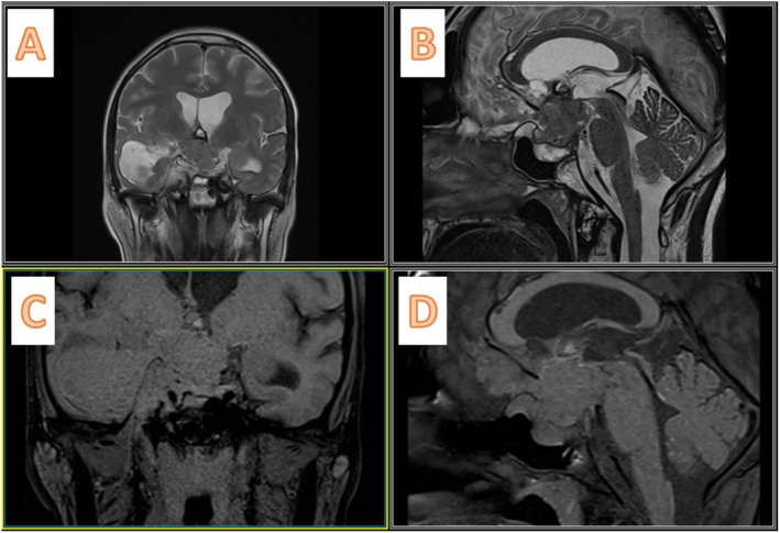 FIGURE 3