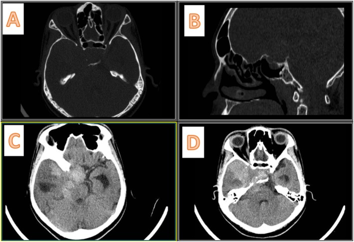 FIGURE 2