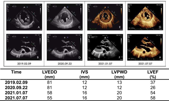 FIGURE 3