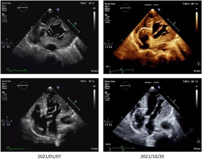 FIGURE 4