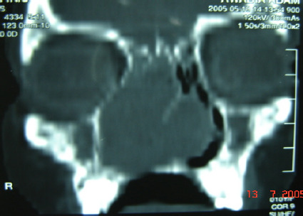 Figure 1-A