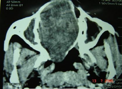 Figure 1-B