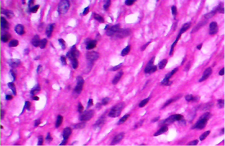 Fig 2-A