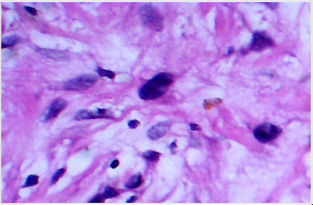 Fig 2-B
