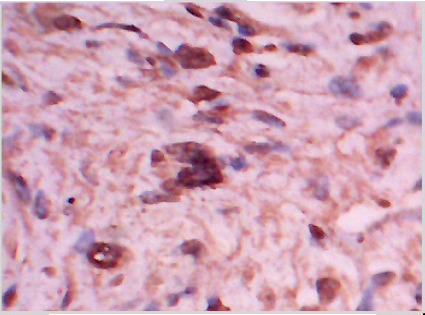 Fig 2-C