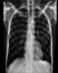 Fig. 2a