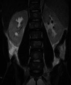 Fig. 3a