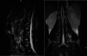 Fig 4a