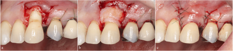 Figure 5