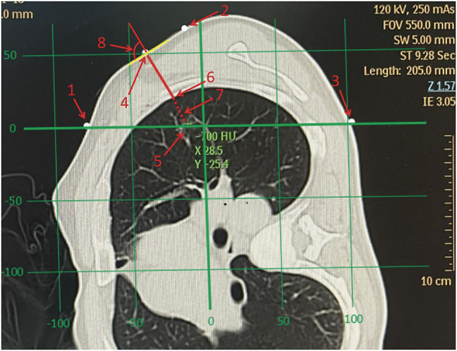 Fig. 2