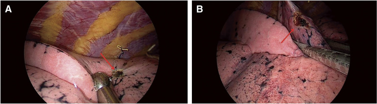 Fig. 6