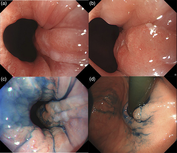 FIGURE 1