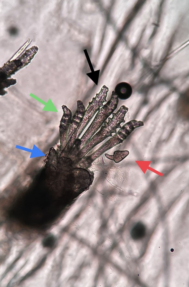 FIGURE 1