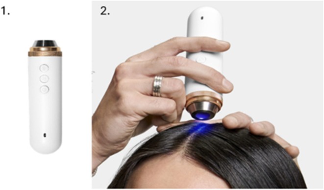 FIGURE 1