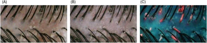 FIGURE 3