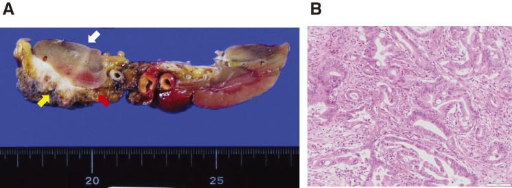 Fig. 6