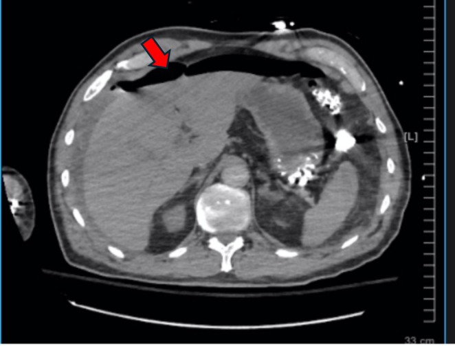 FIGURE 2