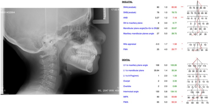 FIGURE 4