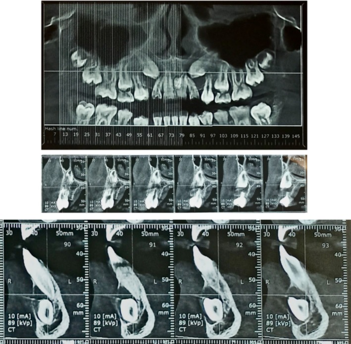 FIGURE 3