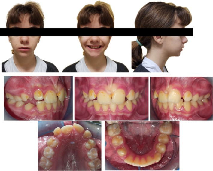FIGURE 1
