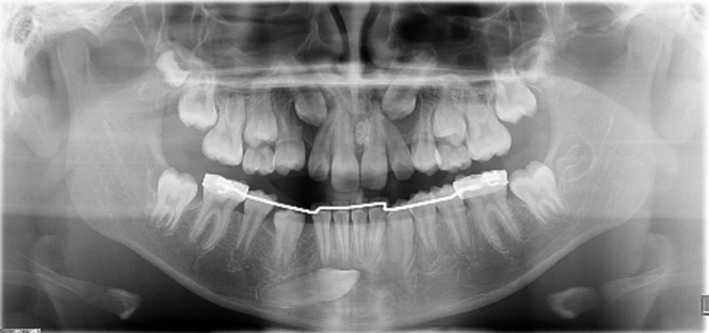 FIGURE 2