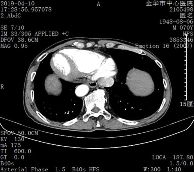 Figure 1