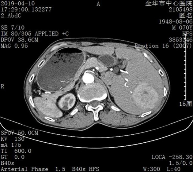 Figure 2