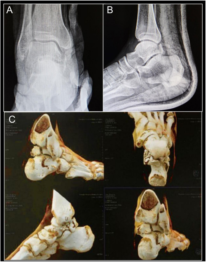 Figure 1