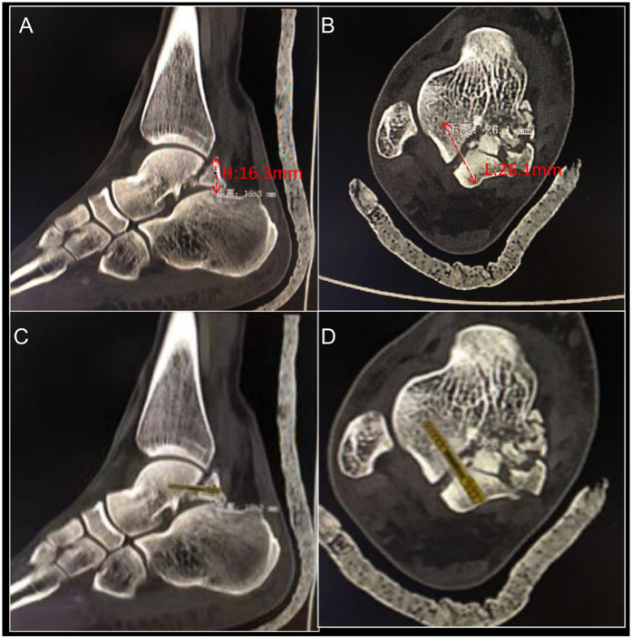 Figure 2