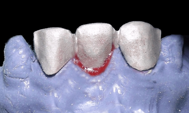 Figure 11