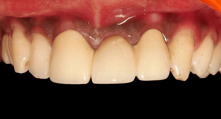 Figure 12