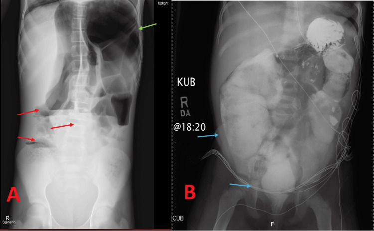 Figure 6