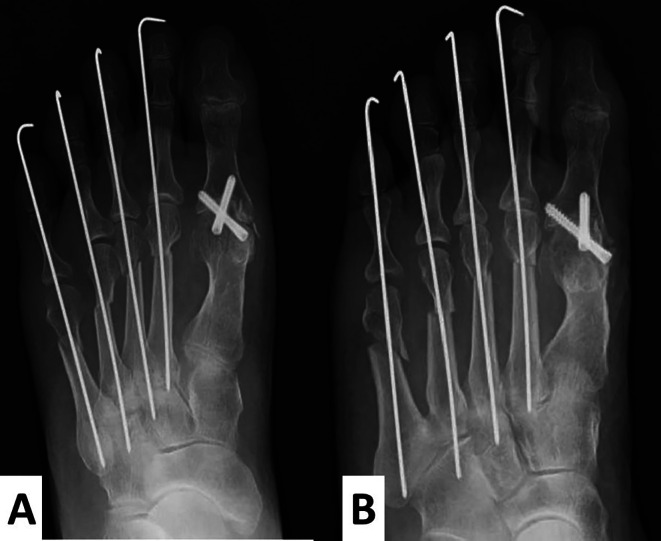 Figure 5
