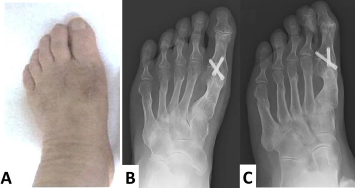 Figure 6
