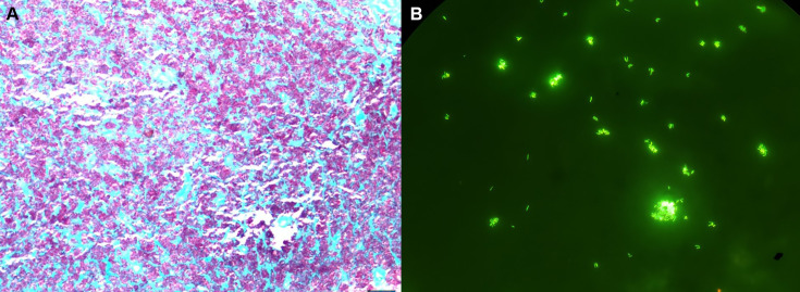 Fig 1