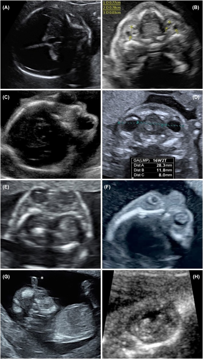 FIGURE 1
