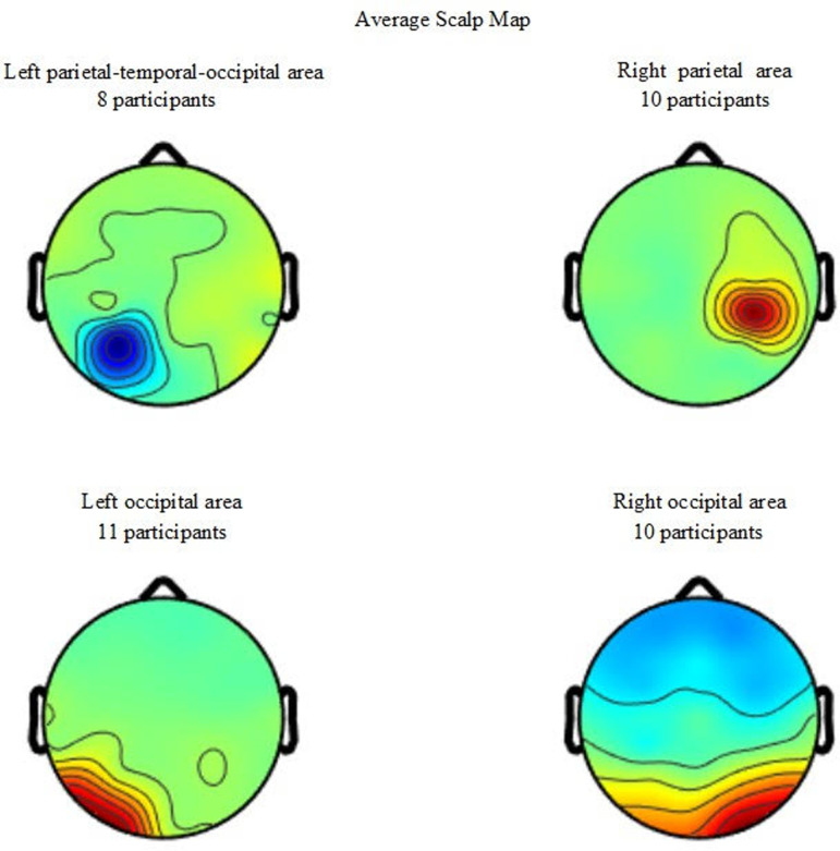 Fig 4