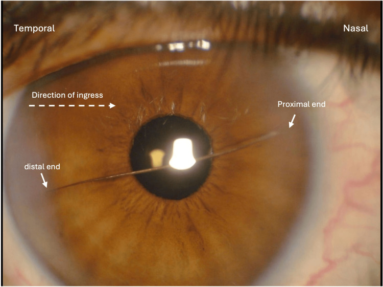 Figure 2