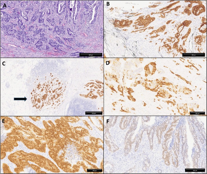 FIGURE 2